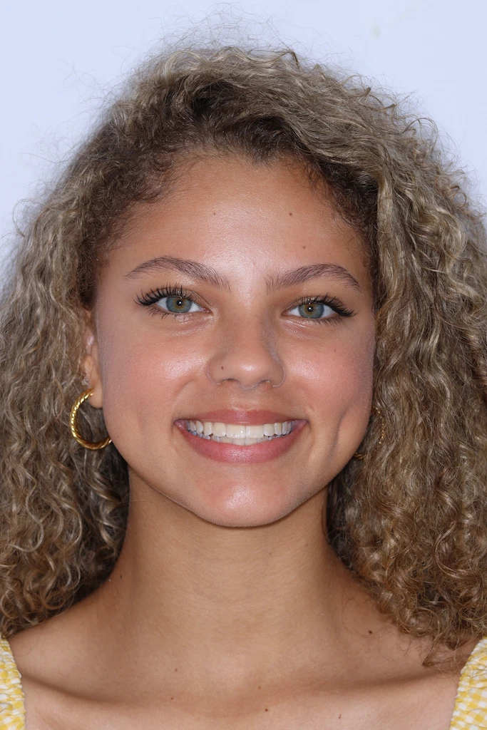 Orthodontist Porter Ranch Results