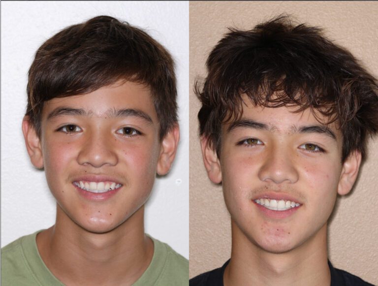 Expert Orthodontist for Kids and Teens Braces & Invisalign